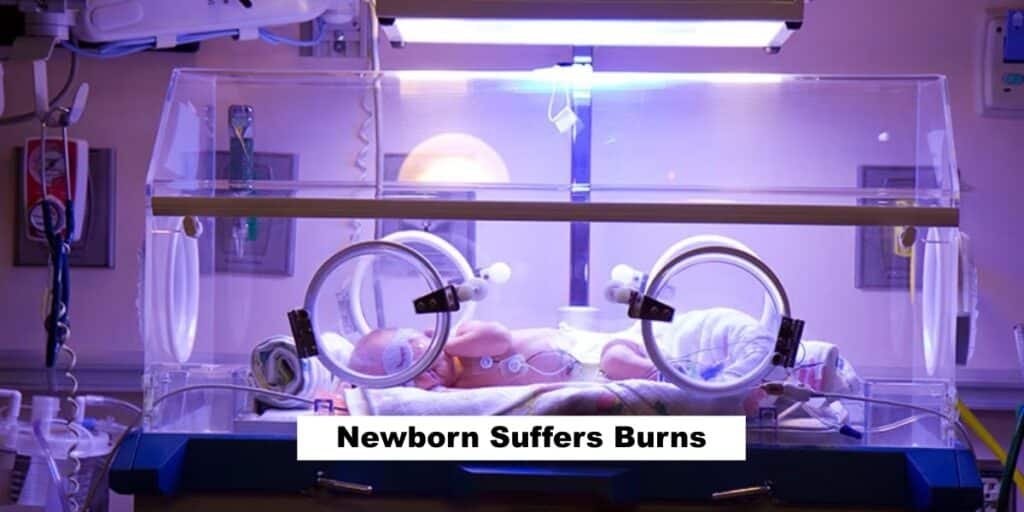 Newborn suffers burns due to overheated incubator at Lahore hospital