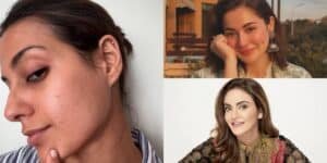Fellow celebs praise Iqra Aziz for opening up about skin problems