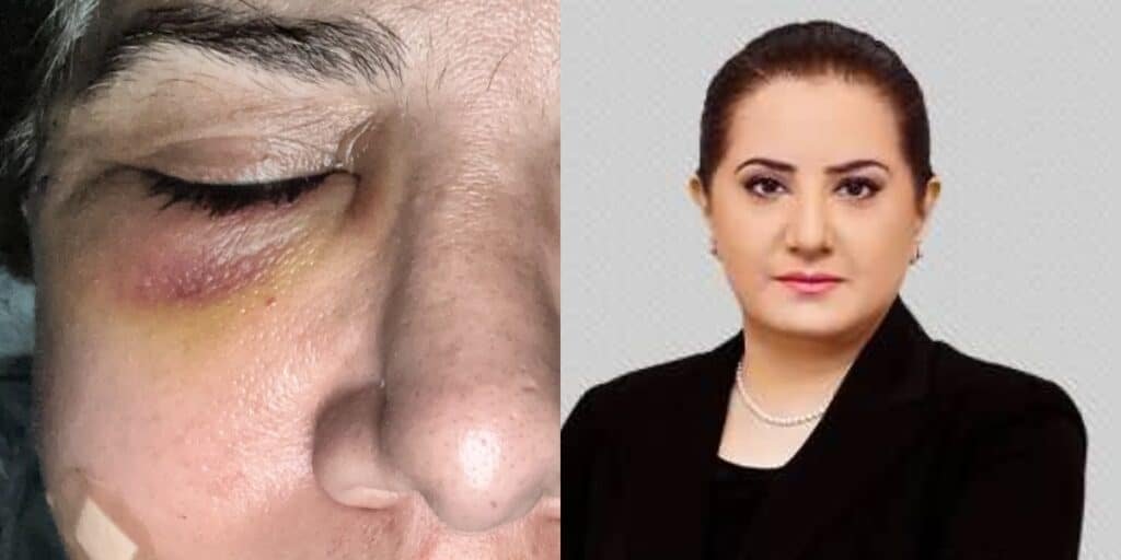 Pakistani TV anchor Jasmeen Manzoor alleges assault by ex-husband